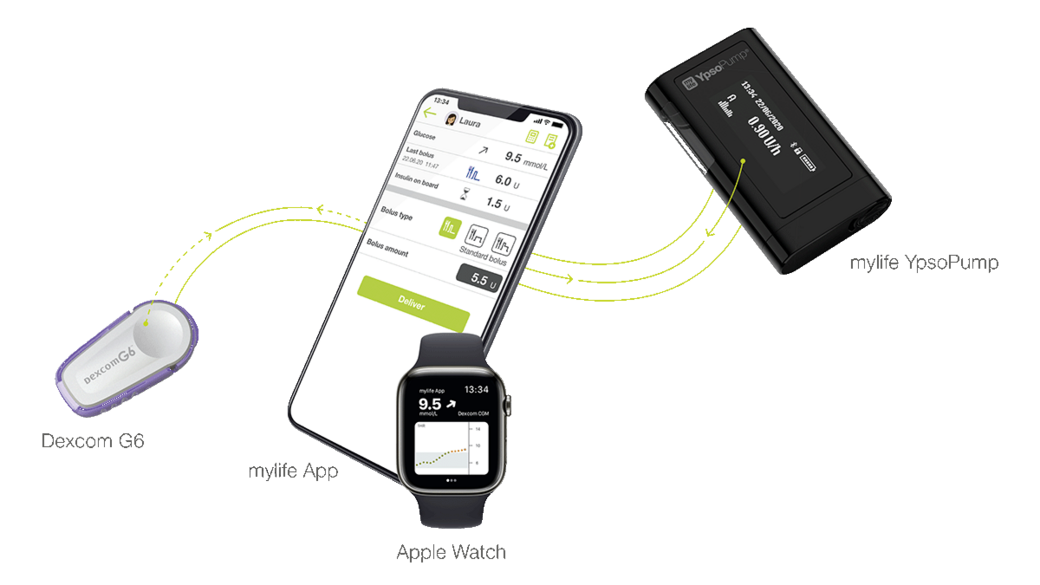 Remote bolus delivery from your smartphone